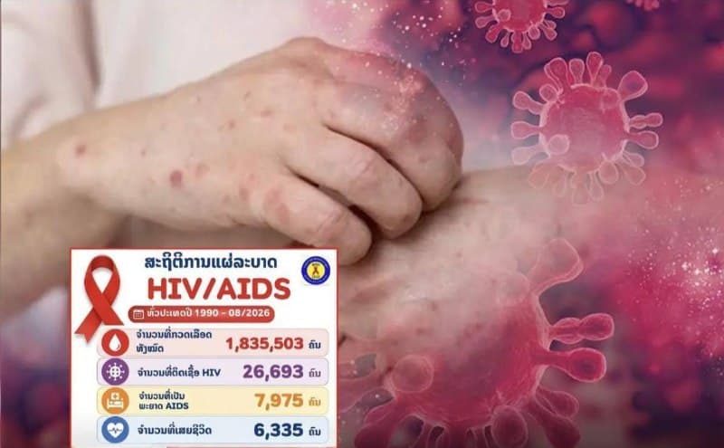 LA Affairs|Laos Reports Over 26,000 HIV Cases as Officials Urge Proactive Screening